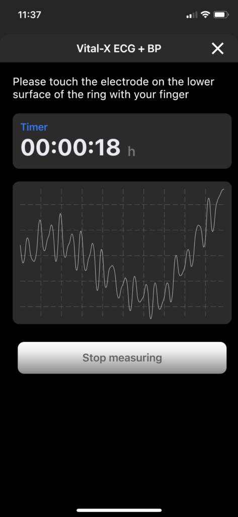 MCRC-Vital-X-Messung-Art-of-Cryo Echtzeit-Monitoring im Multi-Cryo-Health System